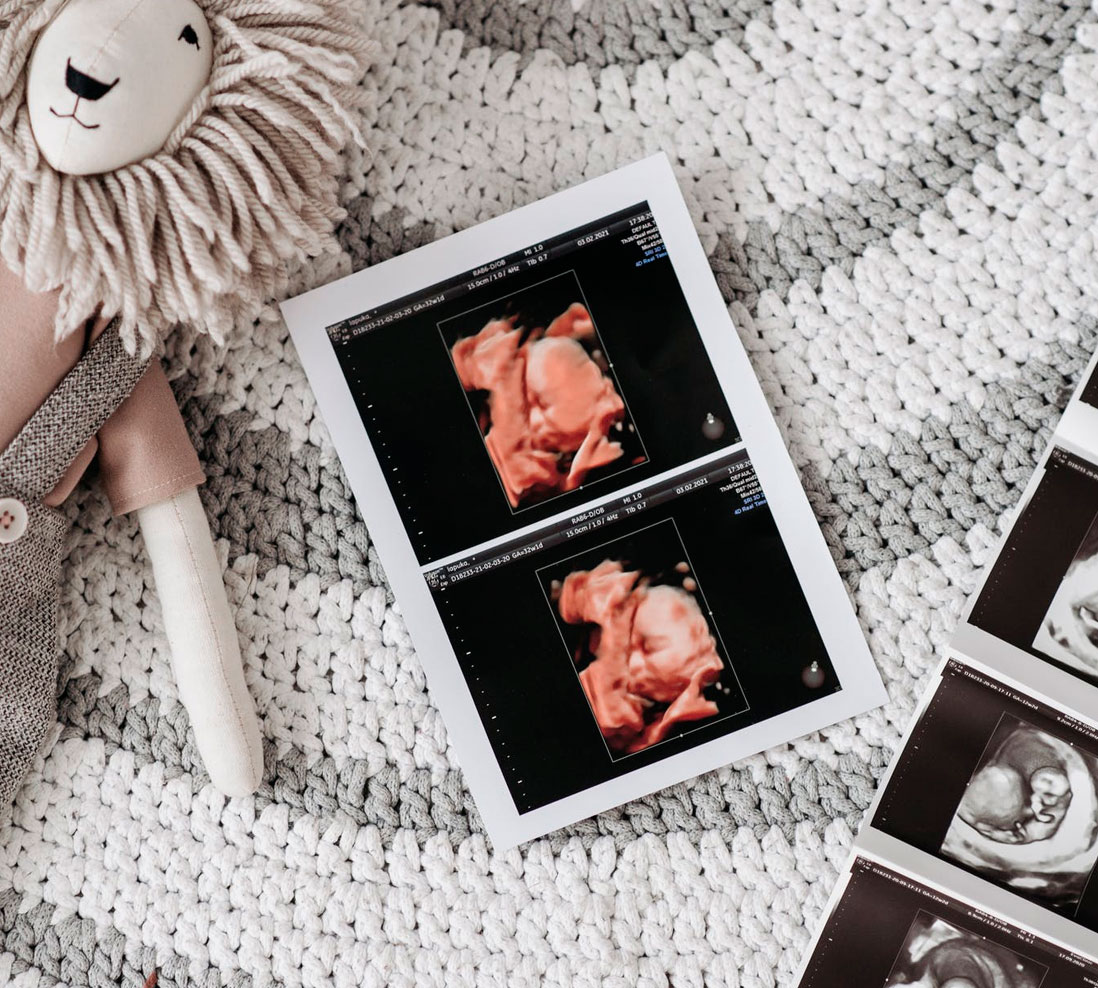 VR Surrogacy consultants - Fase 4 Cuenta regresiva